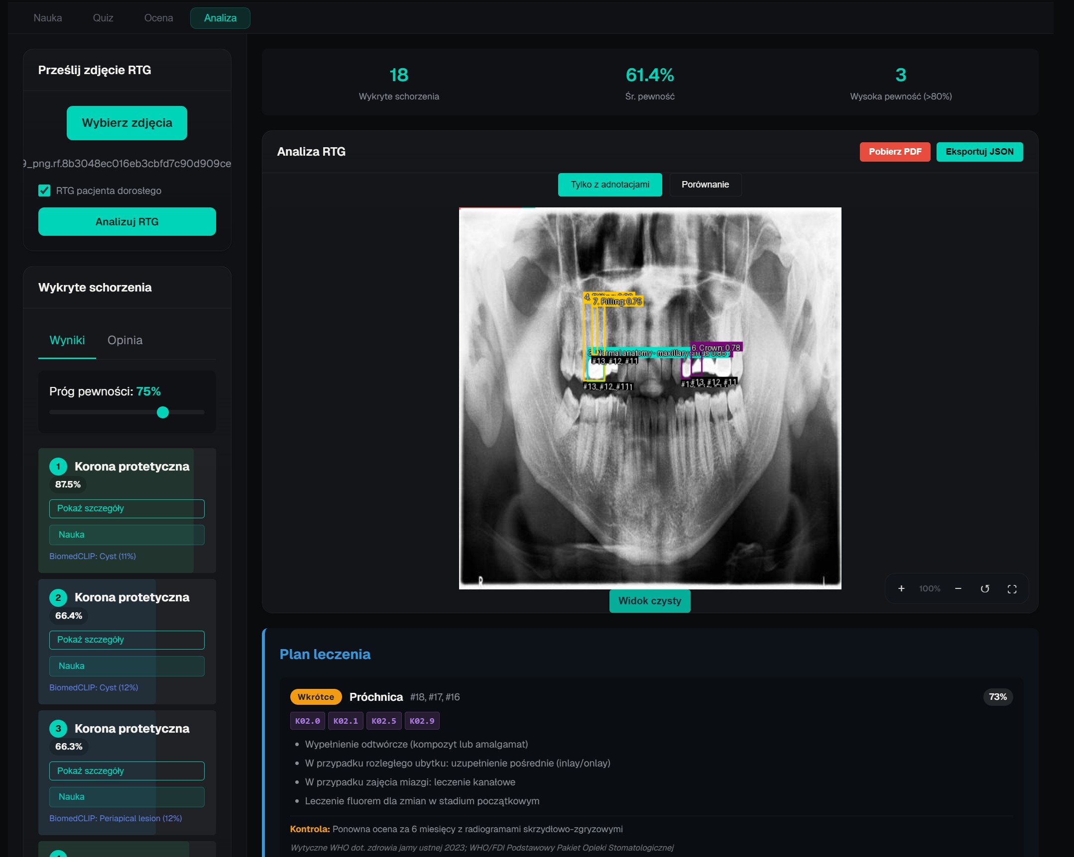 Analyze mode